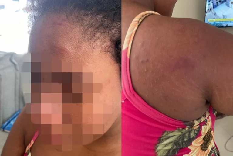 Patroa agride e tortura doméstica grávida em Paço do Lumiar