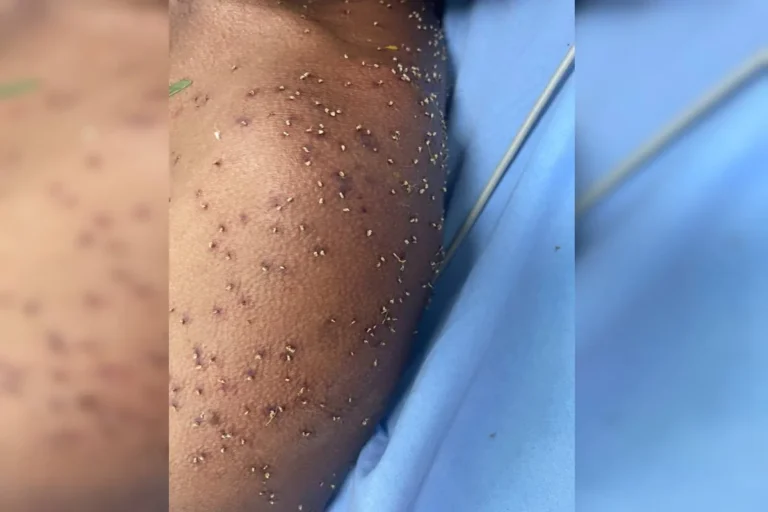 Homem é resgatado inconsciente após ataque de enxame de abelhas em Goiás